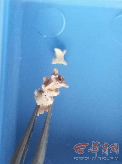 陕西首次发现珍贵蛇类化石 每节仅3毫米
